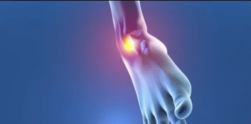 Ankle rehabilitation
