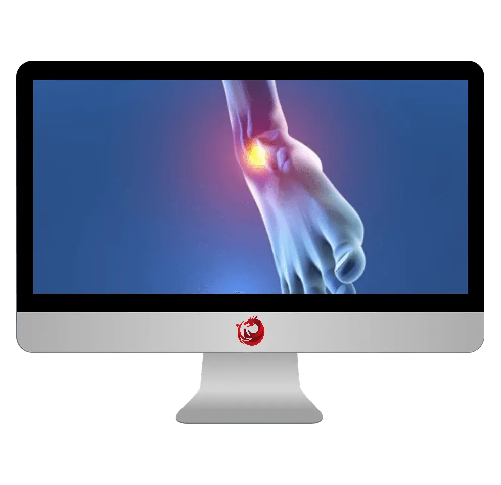 Ankle rehabilitation