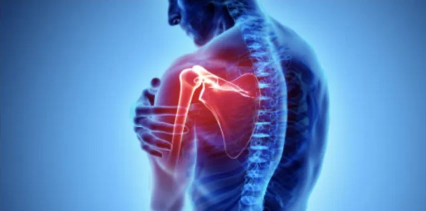 Shoulder rehabilitation